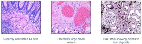 Science of H&E - Stained vs. Unstained Tissue Slides