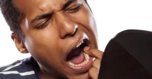 Image result for Tooth Mobility Problem