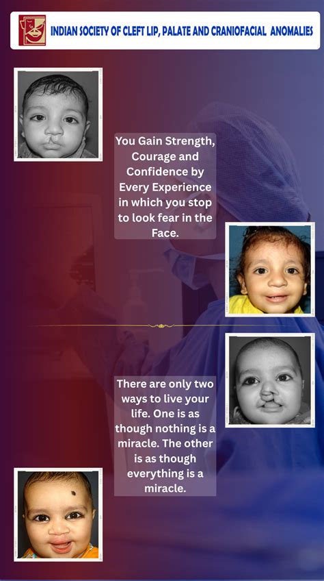 Indian Society of Cleft Lip, Palate And Craniofacial Anomalies
