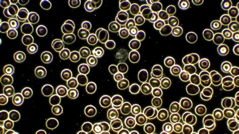 Dark-field Microscopy: Holistic Blood Analysis | Alpine BioMedical