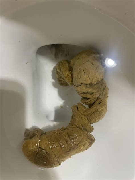 Normal color? : r/poop