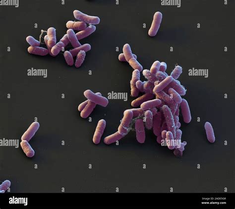 Enterobacter cloacae bacteria, coloured scanning electron micrograph ...