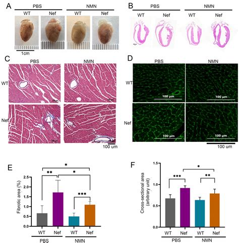 Administration of Nicotinamide Mononucleotide Mitigates the HIV Nef ...