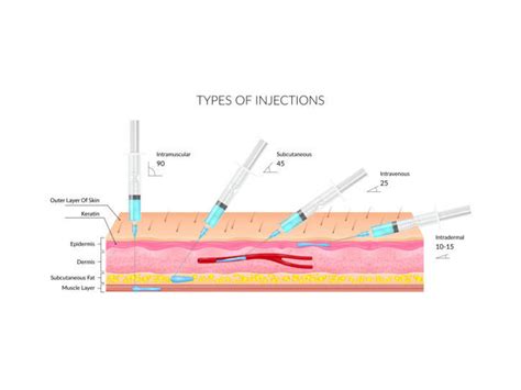 Image result for All Types of Injection