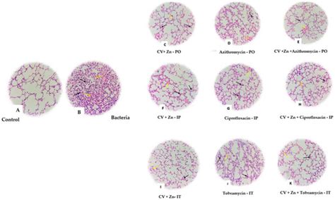 In Vitro and In Vivo Antibacterial and Antibiofilm Activity of Zinc ...