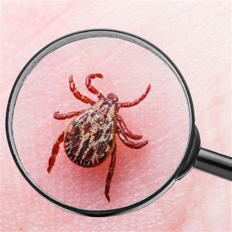 Integrative Lyme Disease Treatment by Dr. Fred Bloem