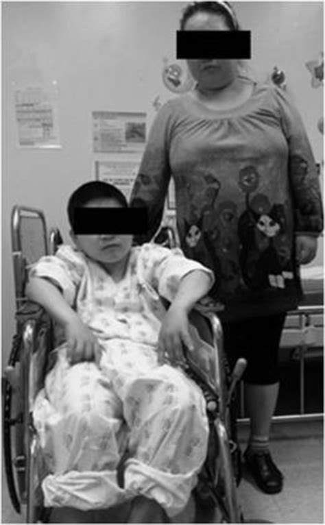 Spinal Stenosis with Paraparesis in a Korean Boy with Albright’s Hereditary Osteodystrophy ...