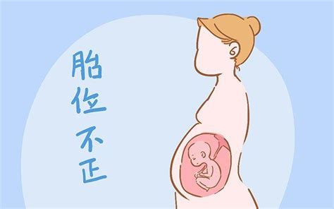 这4种孕妇不适合左侧睡，易导致胎儿缺氧 - 每日头条