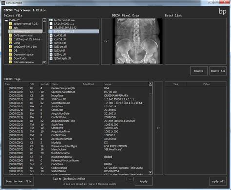 Load File DICOM Viewer 的图像结果