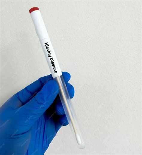 Premium Photo | Saliva sample for infectious mononucleosis (mono) test, kissing disease caused ...