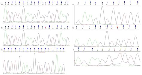 The Relationship of ABCB1/MDR1 and CYP1A1 Variants with the Risk of ...