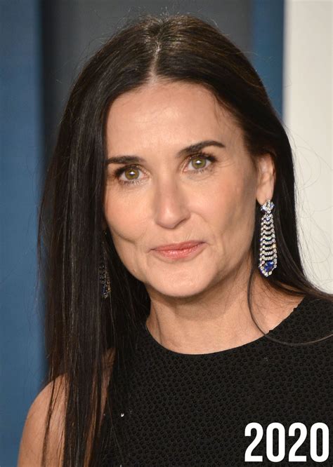A Plastic Surgeon Breaks Down Demi Moore’s ‘New Face’ And Analyzes Her Facial Changes Over The ...