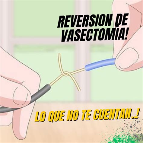 La Vasectomia Es Reversible