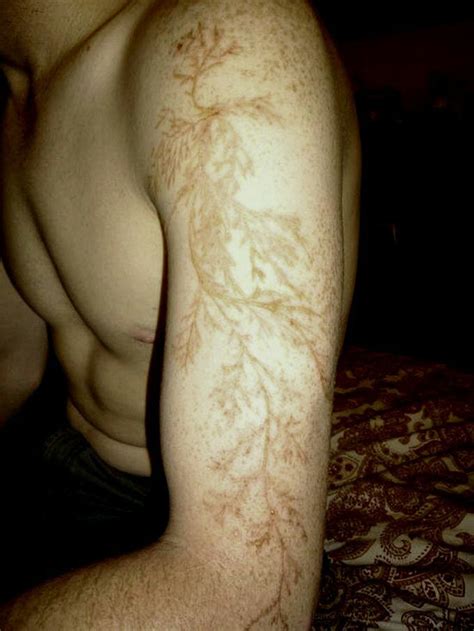 Scar from getting struck by lightning actually looks nice - 9GAG