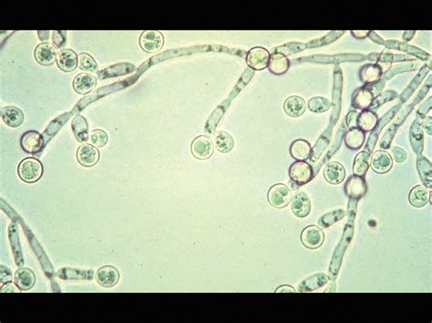 酵母菌是真菌吗，怎么繁殖 - 农敢网