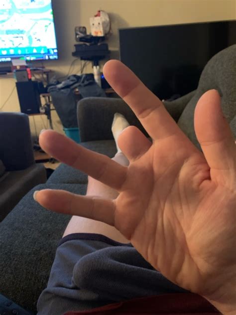 Image result for Stumpy One Hand