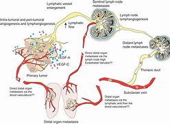 lymphangiogenesis 的图像结果