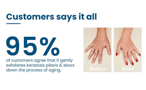 Buy FCL Bio Retinol Body Lotion, For Skin- Ageing, Keratosis Pilaris ...