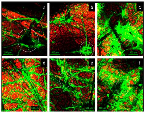 Current Advances in Lipid Nanosystems Intended for Topical and ...