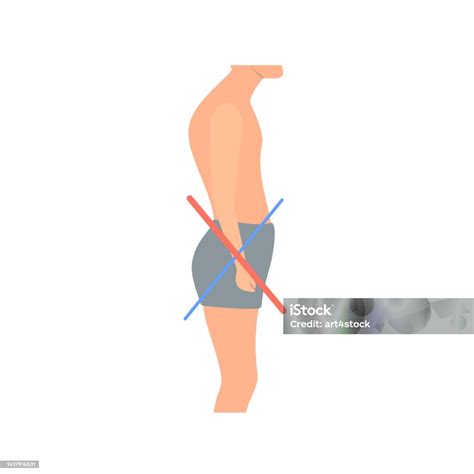 Crooked Man With Lower Crossed Syndrome Imbalance Stock Illustration ...