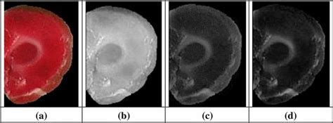 Image result for Contralateral Hemisphere