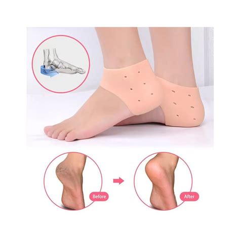 Buy WDS Silicon Gel Heel Socks Pad Online at Best Price In India - Cureka