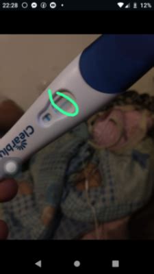 Ultrassom no começo da gravidez | BabyCenter