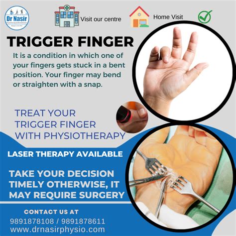 Early Treatment For Trigger Finger at Randall Graves blog