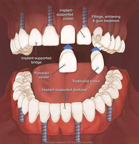 What Is A Prosthodontist