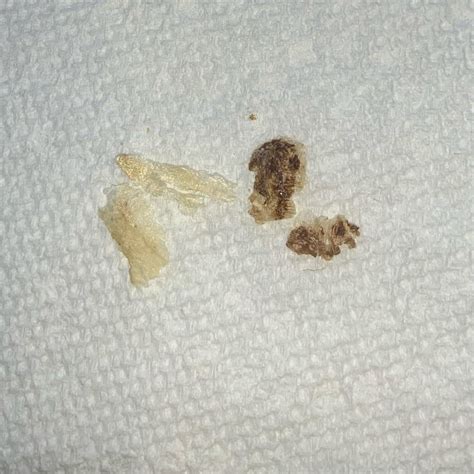 My ears are constantly itchy! Like they itch alllll the time. Ever ...