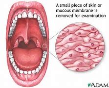 Image result for mucosal