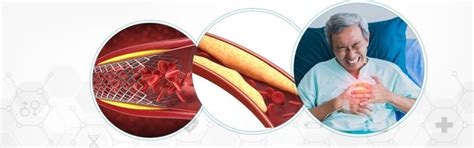 Best Hospital in Batala | EMC Super Speciality Hospital