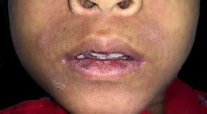 Artikel Terkait - Alomedika