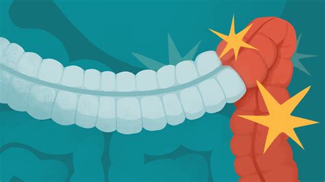 Image result for How to Use IBD