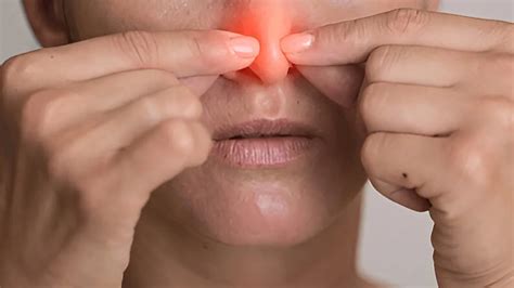 The Hidden Dangers Of Nasal Polyps: Why A Stuffy Nose Isn't Just A Cold ...