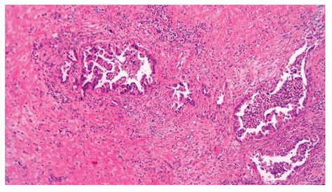 The Role of Imaging Methods and CDX2 Immunostaining in Diagnosis and ...