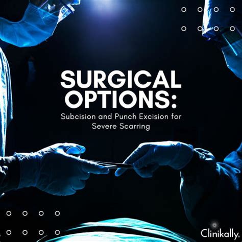 Top Acne Scar Treatments for Men: Clear Skin Guide | Clinikally