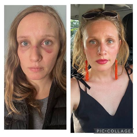 Before and After Alcohol — Sobertown Podcast | Sobriety Podcast ...