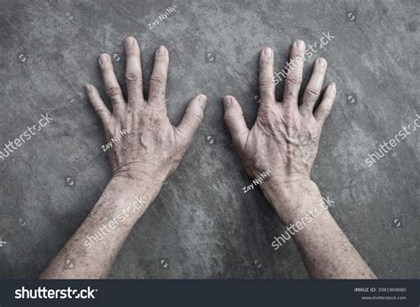Age Spots On Hands Asian Elder Stock Photo 2081969680 | Shutterstock