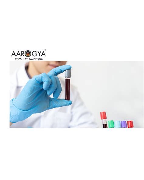 Aarogya Pathcare: Full Body Checkup 89 Test @ 999/- Book Now