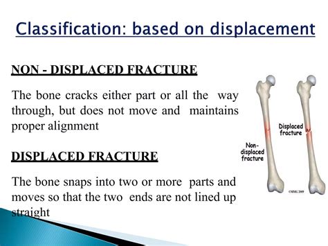 fracture.pdf