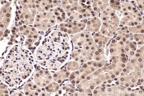 IHCeasy CDC27 Ready-To-Use IHC Kit KHC2227 | Proteintech