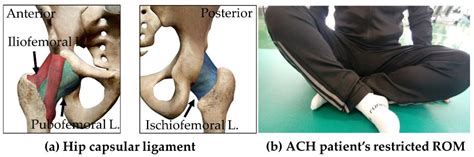 Biomechanical Asymmetry of Strength and Dynamic Balance Kinetics in ...