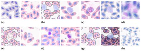 Identifying and Counting Avian Blood Cells in Whole Slide Images via ...