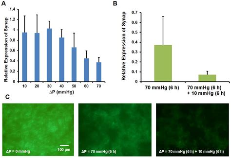 A Microfluidic Platform for Investigating Transmembrane Pressure ...