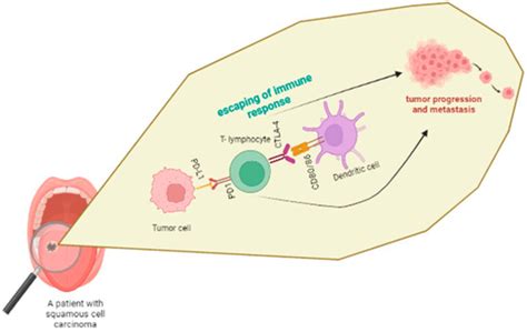 Immune Cells in Head-and-Neck Tumor Microenvironments
