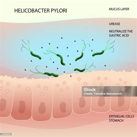 Ilustración de Bacteria Helicobacter Pylori En La Capa Mucosa Del Estómago Humano y más Vectores ...
