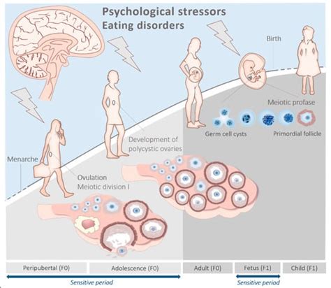 Polycystic Ovary Syndrome: A Brain Disorder Characterized by Eating ...