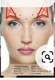 Image result for Botox Injection Patterns