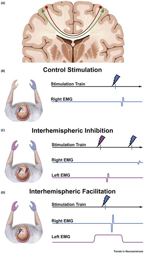 The Cortical Physiology of Ipsilateral Limb Movements: Trends in ...